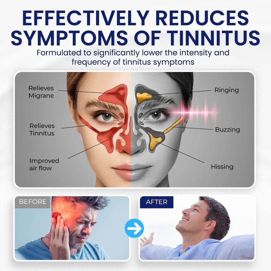 Lyyeto® CalmAura Tinnitus Relief Drops