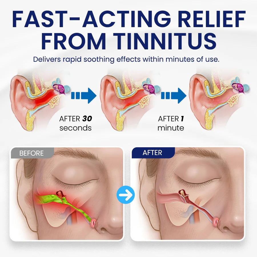 Lyyeto® CalmAura Tinnitus Relief Drops