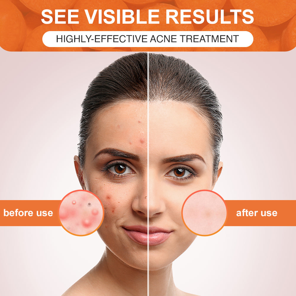 Luhaka Complex Acid Carrot Foam Facial Mask (with Brush)