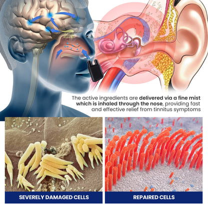 Luhaka™ Sonose Tinnitus Relief Dual Nasal Inhaler 🔥