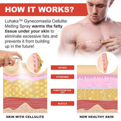 Luhaka™ - Gynecomastia Cellulite Melting Spray