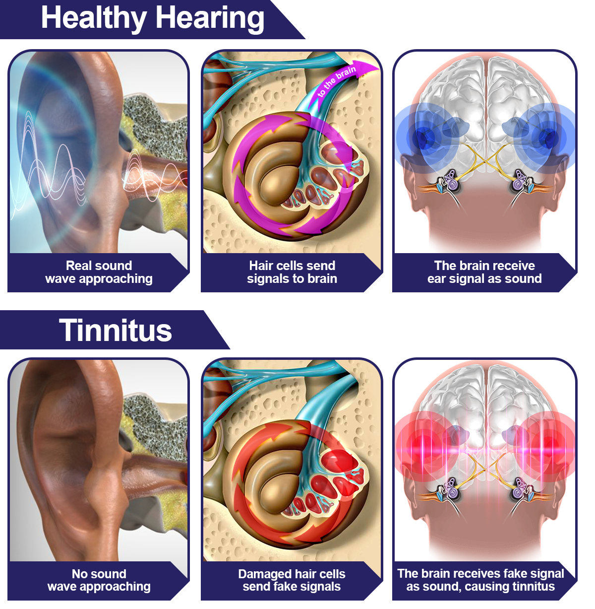 DAFEILA® Infrapeace Red Light Therapy Ear Plugs