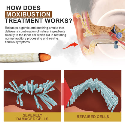 Luhaka™ Tinnitus Relief Moxastick